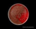 Virulent pneumococci